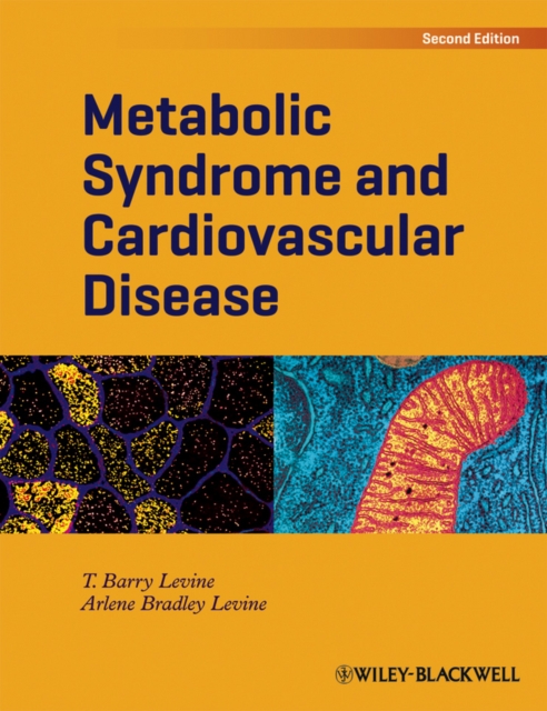 Metabolic Syndrome and Cardiovascular Disease, Hardback Book