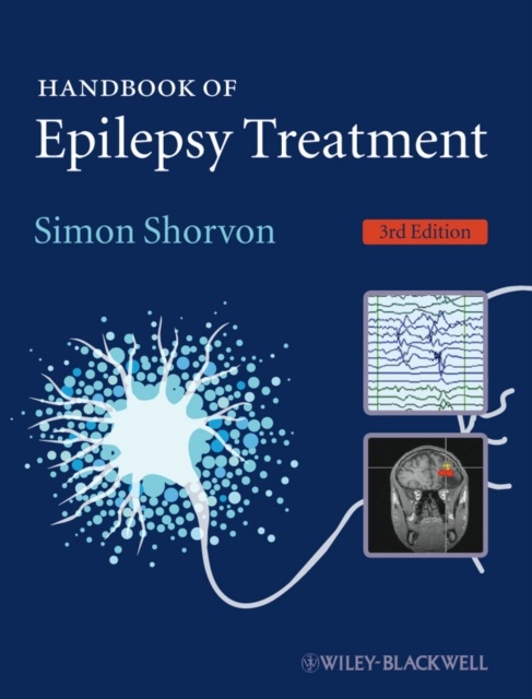 Handbook of Epilepsy Treatment, Paperback / softback Book