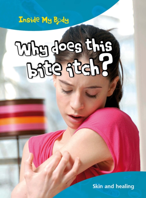 Why does this Bite Itch?, PDF eBook