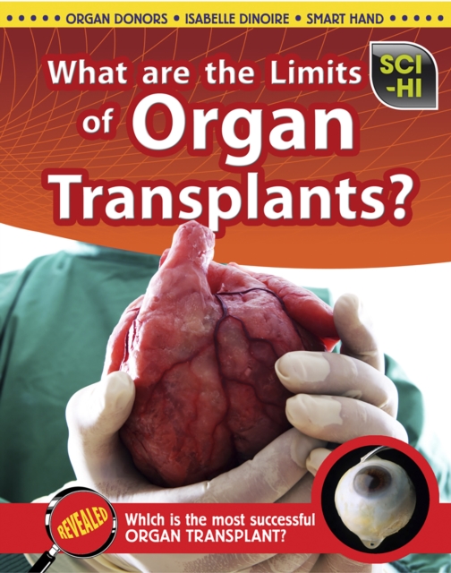 What Are the Limits of Organ Transplantation?, Hardback Book