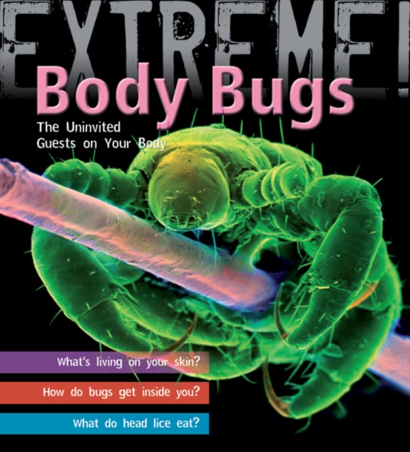 Extreme Science: Body Bugs! : The Uninvited Guests on Your Body, Hardback Book