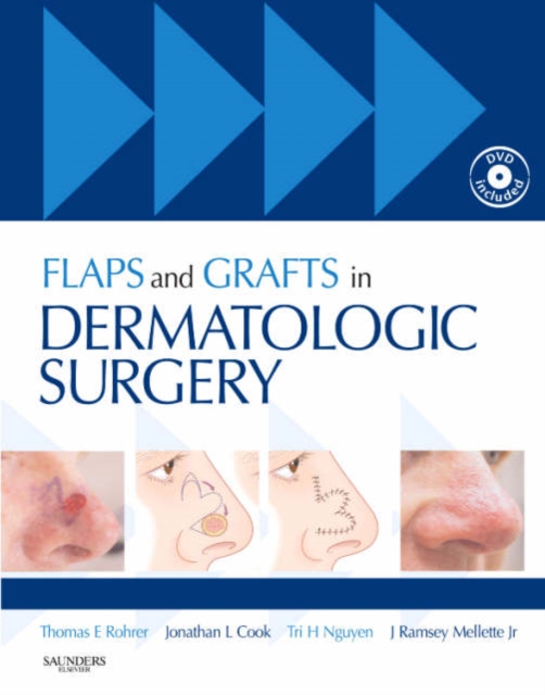Flaps and Grafts in Dermatologic Surgery, Mixed media product Book