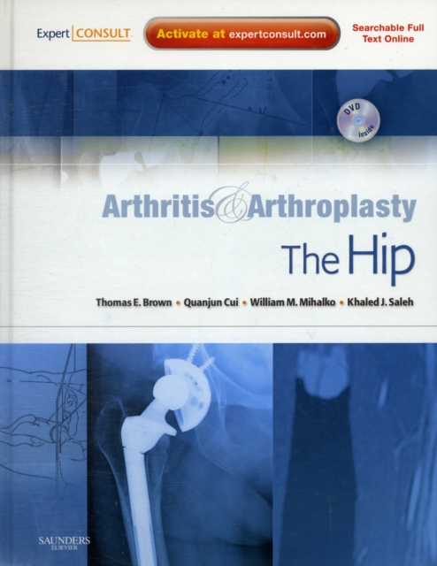 Arthritis and Arthroplasty: The Hip : Expert Consult - Online, Print and DVD, Hardback Book