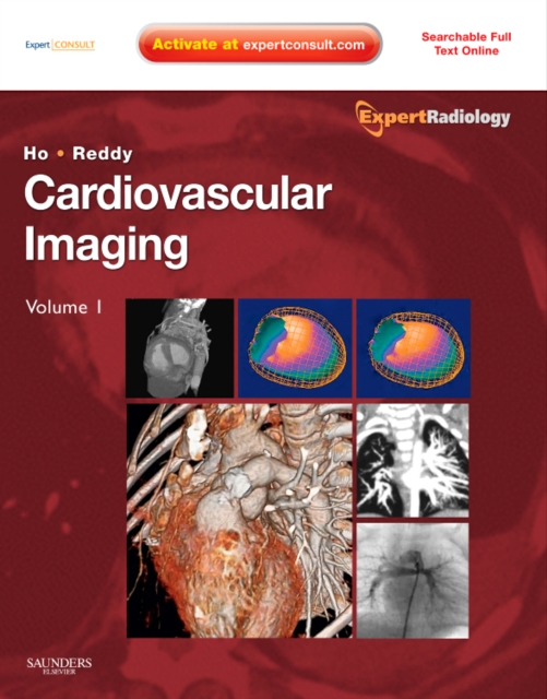 Cardiovascular Imaging, 2-Volume Set : Expert Radiology Series, Hardback Book