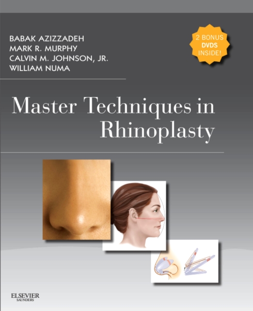 Master Techniques in Rhinoplasty with DVD, Hardback Book