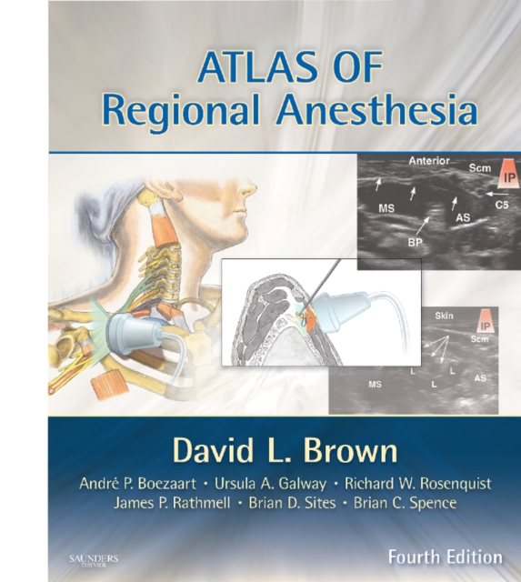 Atlas of Regional Anesthesia, Hardback Book