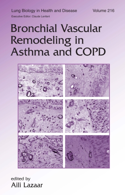 Bronchial Vascular Remodeling in Asthma and COPD, PDF eBook