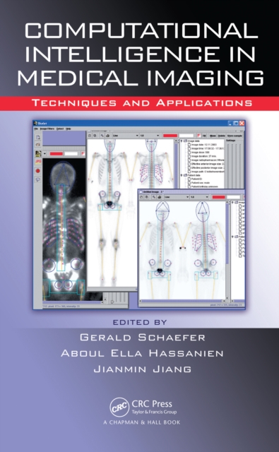 Computational Intelligence in Medical Imaging : Techniques and Applications, PDF eBook
