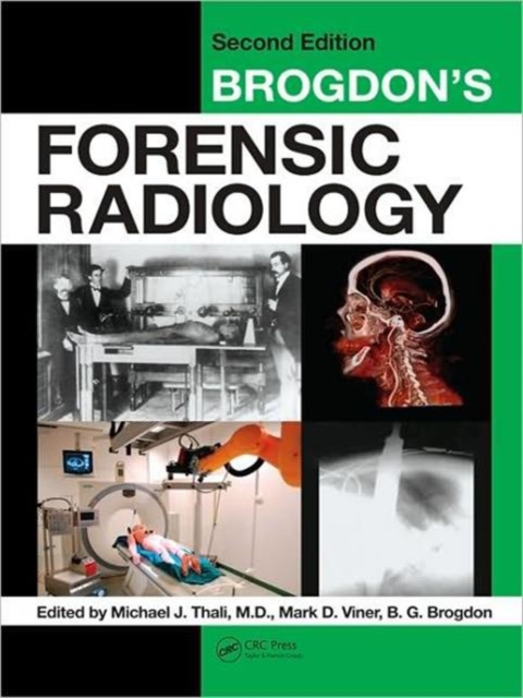 Brogdon's Forensic Radiology, Hardback Book