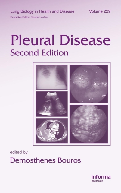 Pleural Disease, Hardback Book