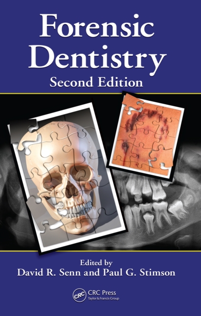 Forensic Dentistry, PDF eBook