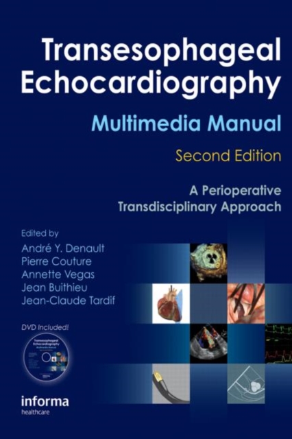 Transesophageal Echocardiography Multimedia Manual : A Perioperative Transdisciplinary Approach, Hardback Book