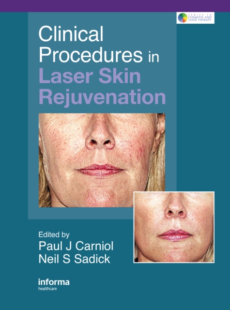 Clinical Procedures in Laser Skin Rejuvenation, PDF eBook