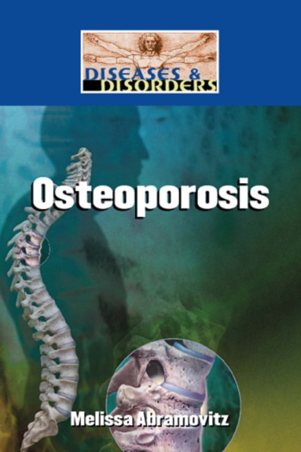 Osteoporosis, PDF eBook