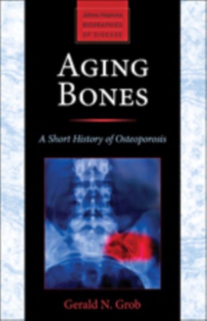 Aging Bones : A Short History of Osteoporosis, Paperback / softback Book