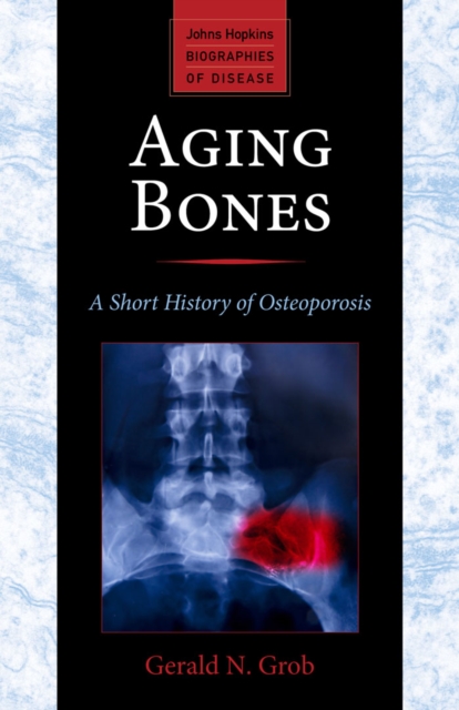 Aging Bones, EPUB eBook
