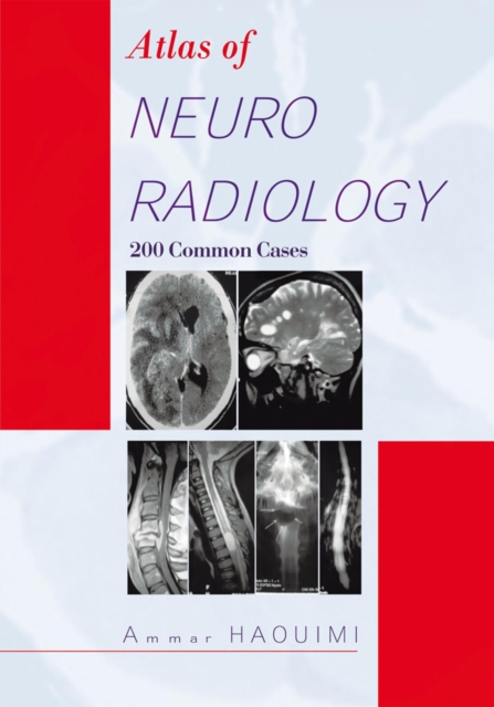 Atlas of Neuroradiology : 200 Common Cases, EPUB eBook