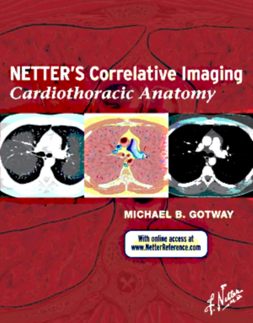 Netter's Correlative Imaging: Cardiothoracic Anatomy, Hardback Book