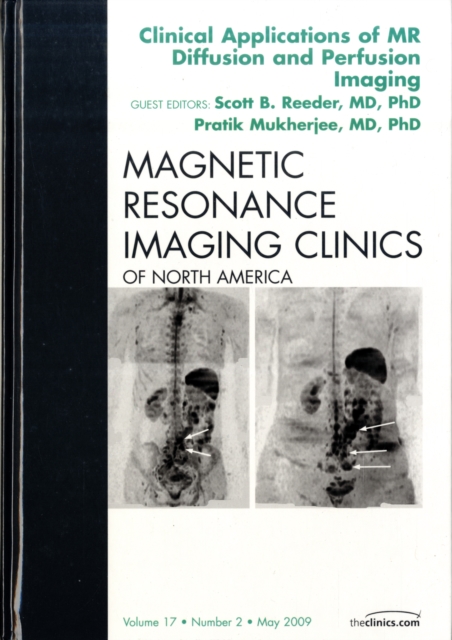 Clinical Applications of MR Diffusion and Perfusion Imaging, An Issue of Magnetic Resonance Imaging Clinics : Volume 17-2, Hardback Book