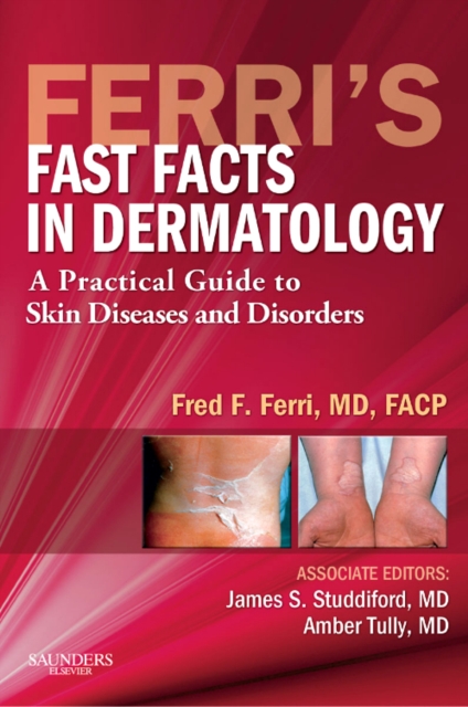 Ferri's Fast Facts in Dermatology : A Practical Guide to Skin Diseases and Disorders, Paperback Book