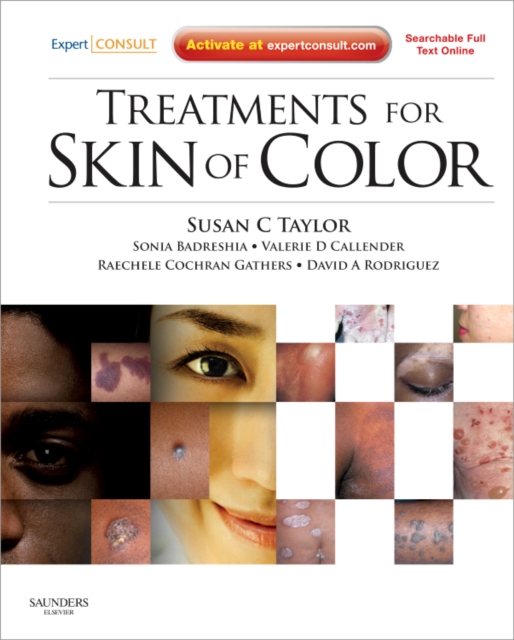 Treatments for Skin of Color : Expert Consult - Online and Print, Hardback Book