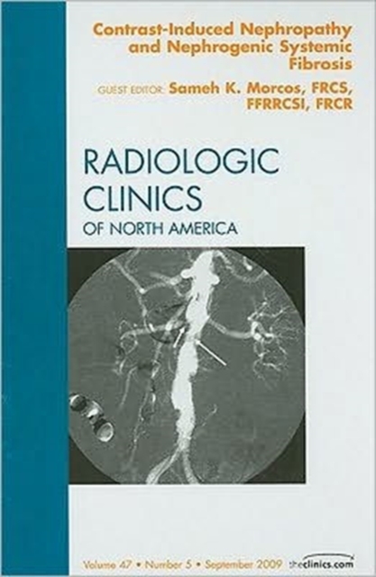 Contrast-Induced Nephropathy and Nephrogenic Systemic Fibrosis, An Issue of Radiologic Clinics of North America : Volume 47-5, Hardback Book