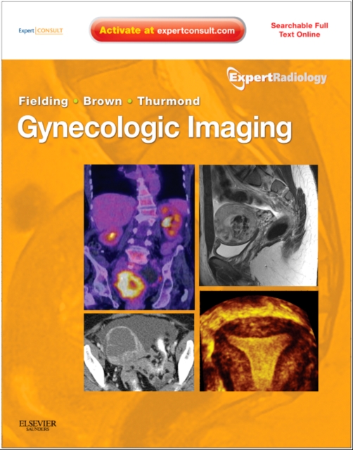Gynecologic Imaging : Expert Radiology Series (Expert Consult Premium Edition - Enhanced Online Features and Print), Hardback Book