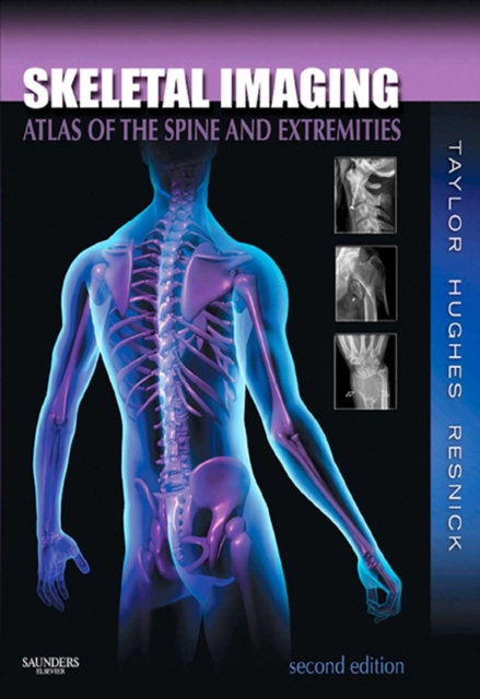 Skeletal Imaging : Atlas of the Spine and Extremities, EPUB eBook