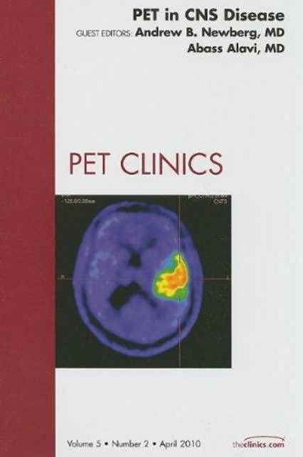 PET in CNS Disease, An Issue of PET Clinics : Volume 5-2, Hardback Book