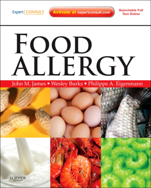 Food Allergy : Expert Consult Basic, Hardback Book