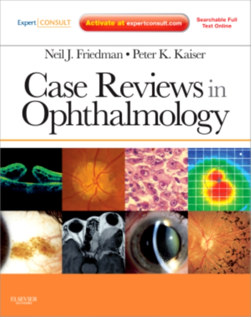 Case Reviews in Ophthalmology, Mixed media product Book
