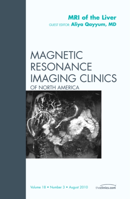 MRI of the Liver, An Issue of Magnetic Resonance Imaging Clinics : Volume 18-3, Hardback Book