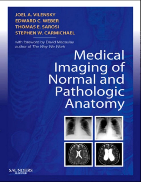 Medical Imaging of Normal and Pathologic Anatomy E-Book : Medical Imaging of Normal and Pathologic Anatomy E-Book, EPUB eBook
