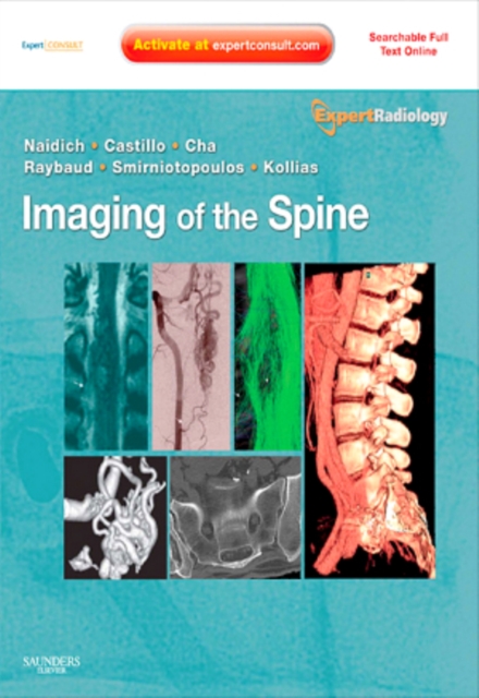 Imaging of the Spine E-Book : Expert Radiology Series, EPUB eBook