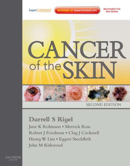 Cancer of the Skin E-Book : Expert Consult, EPUB eBook