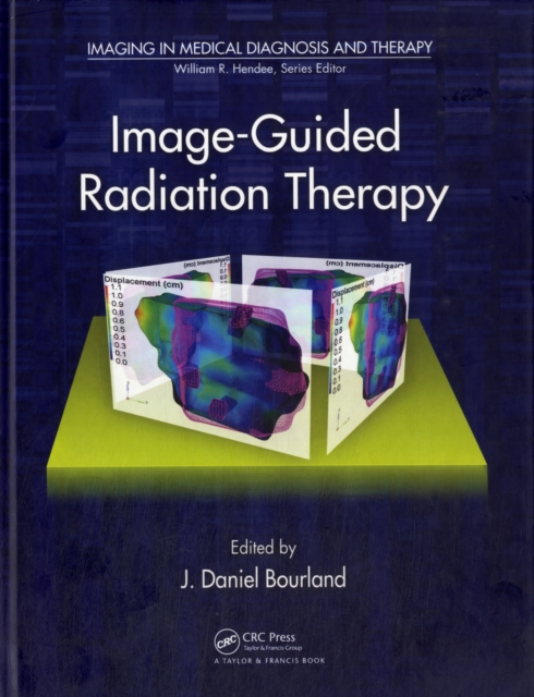Image-Guided Radiation Therapy, PDF eBook