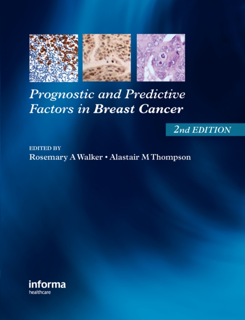 Prognostic and Predictive Factors in Breast Cancer, PDF eBook