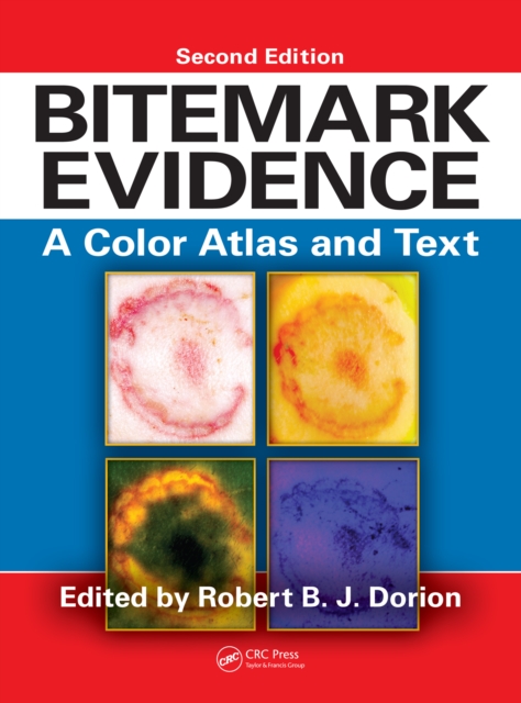 Bitemark Evidence : A Color Atlas and Text, 2nd Edition, PDF eBook