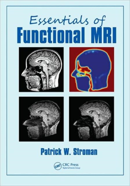 Essentials of Functional MRI, Paperback / softback Book