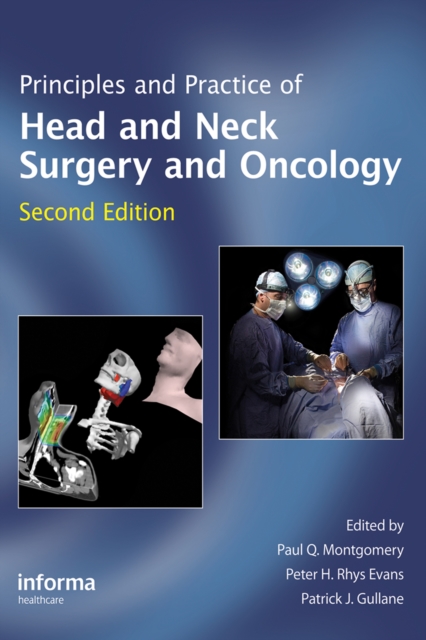 Principles and Practice of Head and Neck Surgery and Oncology, PDF eBook