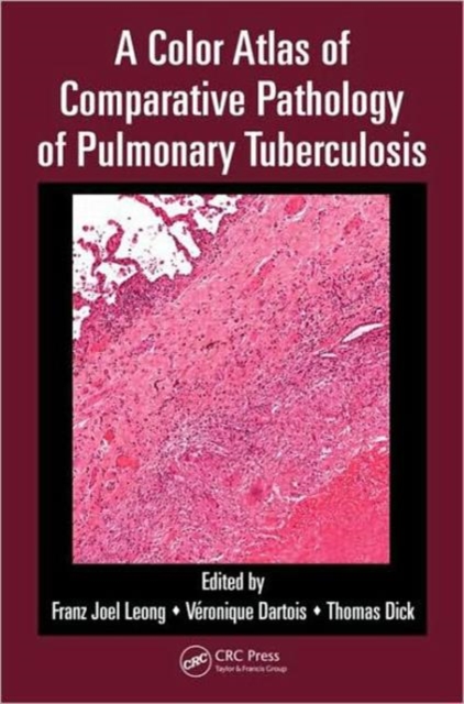 A Color Atlas of Comparative Pathology of Pulmonary Tuberculosis, Paperback / softback Book