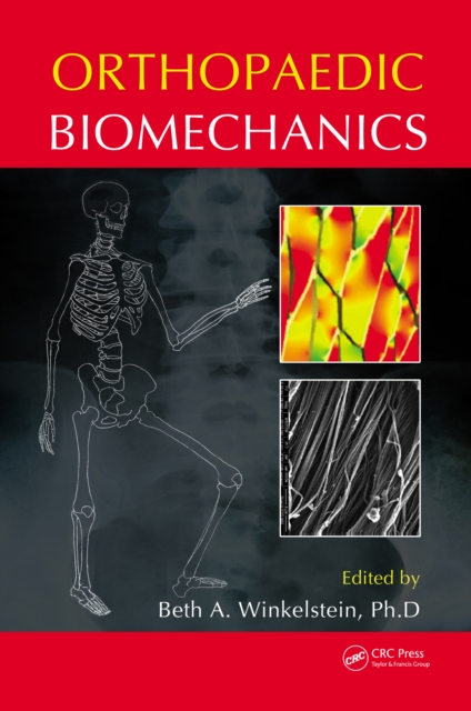 Orthopaedic Biomechanics, PDF eBook