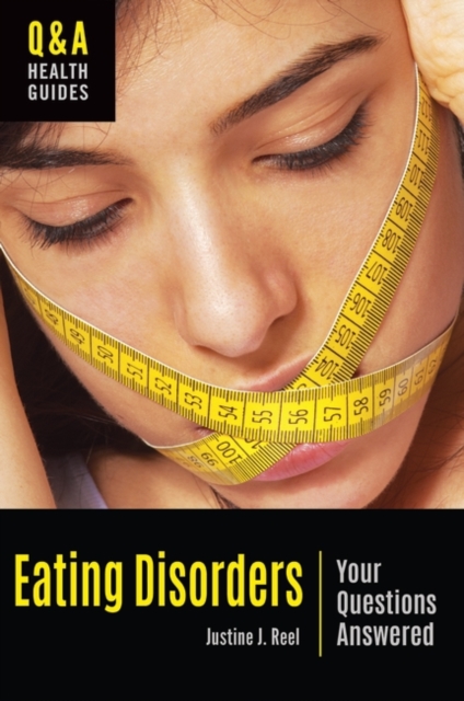 Eating Disorders : Your Questions Answered, Hardback Book