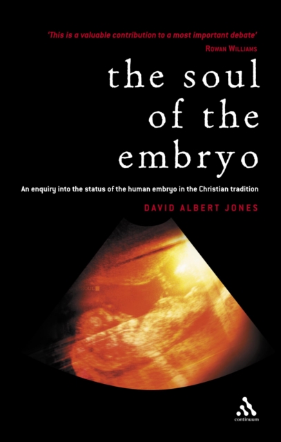 Soul of the Embryo : Christianity and the Human Embryo, PDF eBook