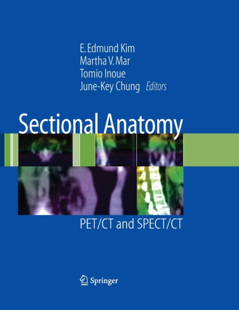 Sectional Anatomy : PET/CT and SPECT/CT, Paperback / softback Book