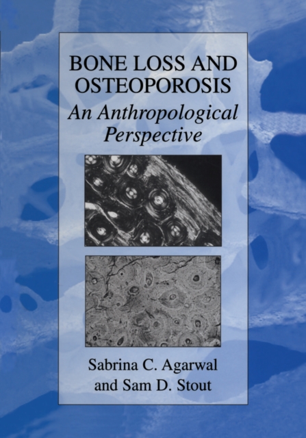Bone Loss and Osteoporosis : An Anthropological Perspective, PDF eBook