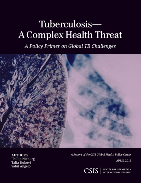 Tuberculosis-A Complex Health Threat : A Policy Primer of Global TB Challenges, Paperback / softback Book