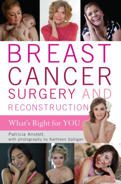 Breast Cancer Surgery and Reconstruction : What's Right For You, Hardback Book