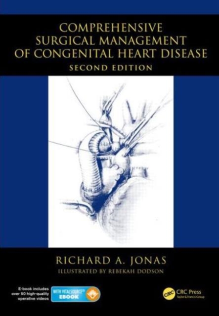 Comprehensive Surgical Management of Congenital Heart Disease, Hardback Book