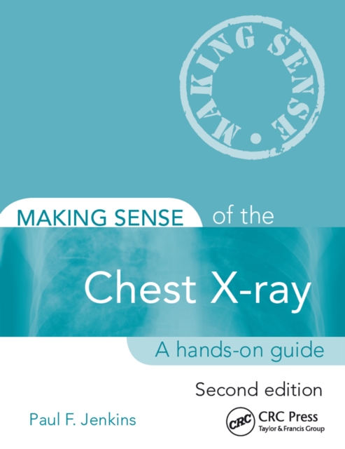 Making Sense of the Chest X-ray : A hands-on guide, PDF eBook